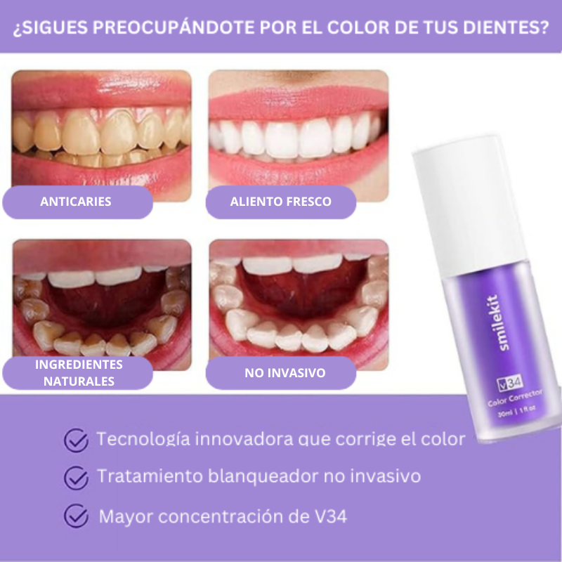 Blanqueador SmileKit Dental™